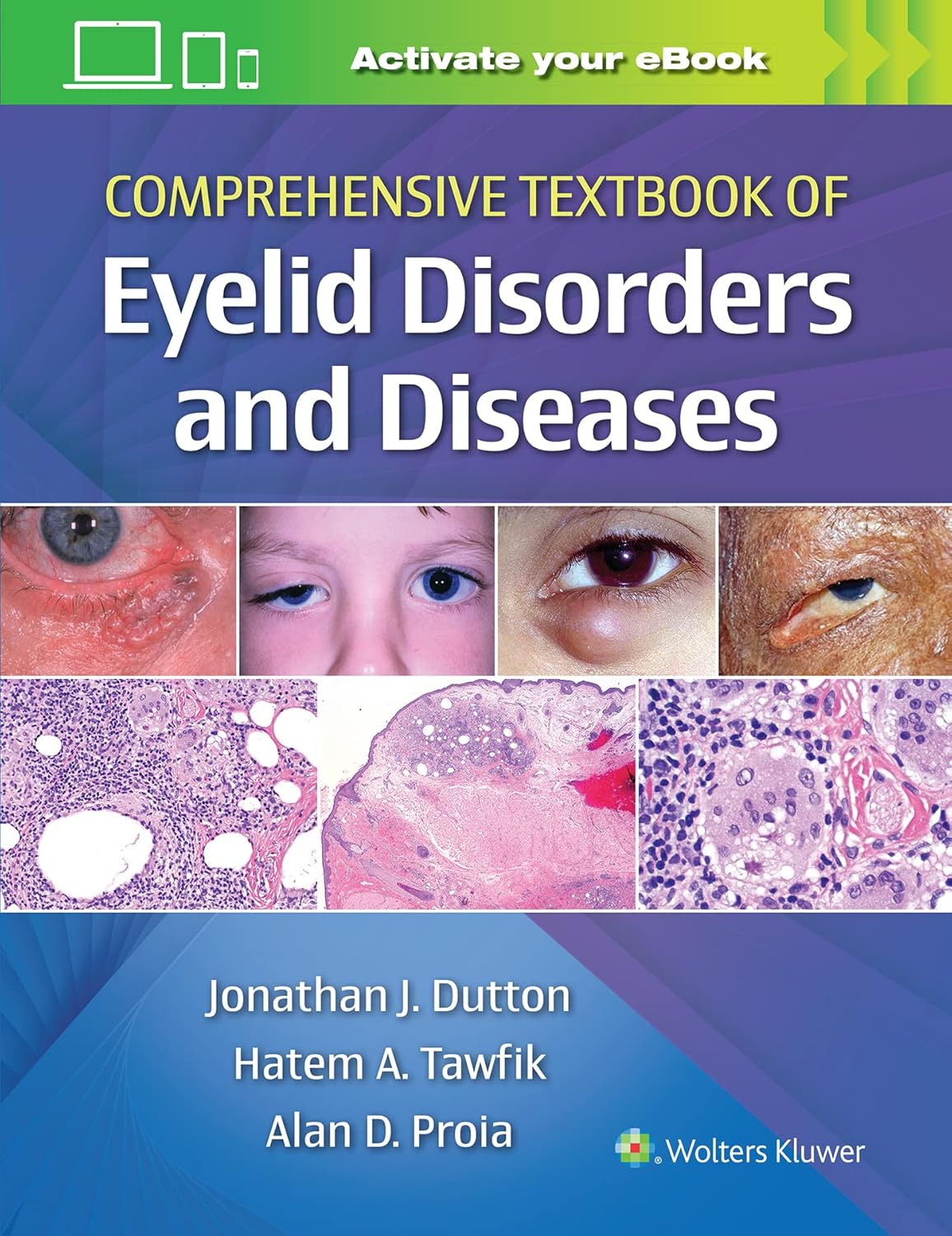 Comprehensive Textbook of Eyelid Disorders and Diseases First Edition