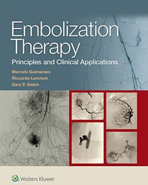 Embolization Therapy: Principles and Clinical Applications First Edition