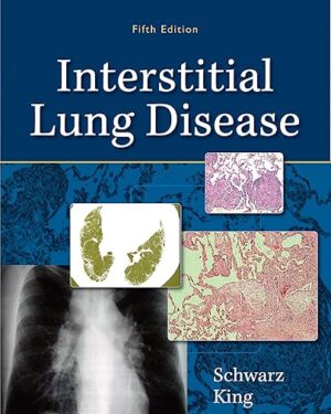Interstitial Lung Disease Kindle Edition