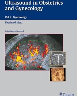 Ultrasound in Obstetrics and Gynecology: Volume 2: Gynecology 2nd edition, fully revised