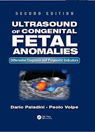 Ultrasound of Congenital Fetal Anomalies: Differential Diagnosis and Prognostic Indicators, Second Edition 2nd Edition