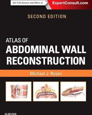 Atlas of Abdominal Wall Reconstruction: Expert Consult 2nd Edition