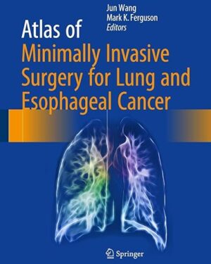 Atlas of Minimally Invasive Surgery for Lung and Esophageal Cancer 1st ed. 2017 Edition