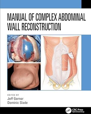 Manual of Complex Abdominal Wall Reconstruction 1st Edition