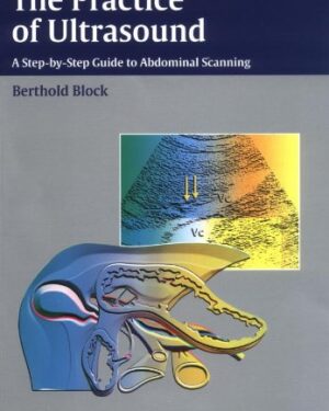 The Practice of Ultrasound A Step-by-Step Guide to Abdominal Scanning