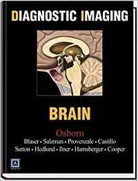 Diagnostic Imaging: Brain 1st Edition