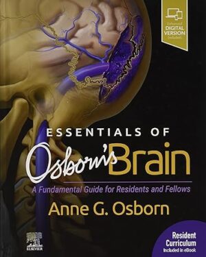 Essentials of Osborn's Brain: A Fundamental Guide for Residents and Fellows 1st Edition