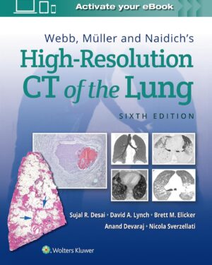 Webb, Müller and Naidich's High-Resolution CT of the Lung Sixth Edition