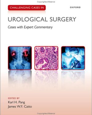 Challenging Cases in Urological Surgery: Cases With Expert Commentary Paperback – 20 Jan. 2023