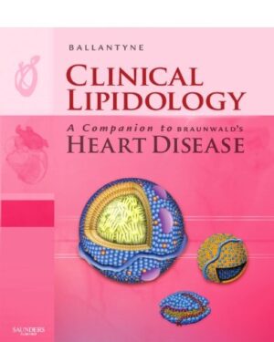 Clinical Lipidology: A Companion to Braunwald's Heart Disease: Expert Consult: 1st Edition