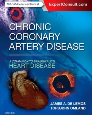 Chronic Coronary Artery Disease: A Companion to Braunwald's Heart Disease 1st Edition