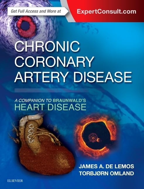 Chronic Coronary Artery Disease: A Companion to Braunwald's Heart Disease 1st Edition