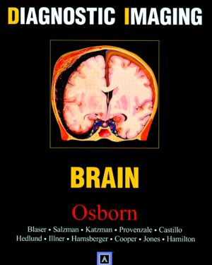Diagnostic Imaging: Brain 1st Edition