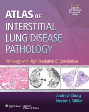 Atlas of Interstitial Lung Disease Pathology: Pathology with High Resolution CT Correlations. First Edition