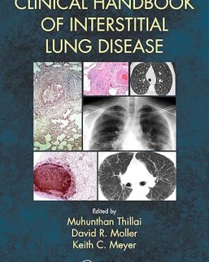 Clinical Handbook of Interstitial Lung Disease 1st Edition, Kindle Edition