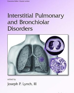 Interstitial Pulmonary and Bronchiolar Disorders (Lung Biology in Health and Disease) Kindle Edition