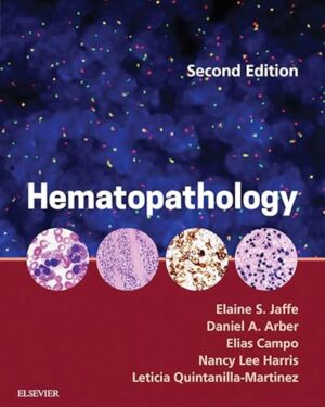 Hematopathology E-Book 2nd Edition, Kindle Edition
